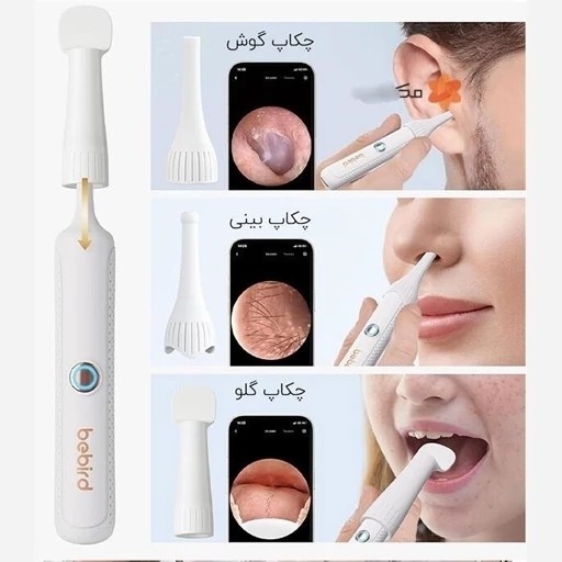 گوش پاکن هوشمندBebird R37 شیائومی کیفیت عالی
